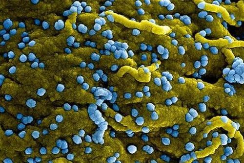 WHO tuyên bố đợt bùng phát loại virus mới, tỉ lệ tử vong tới 90%