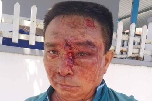 Thông tin mới nhất vụ người đàn ông bị tài xế, phụ xe khách đánh dã man