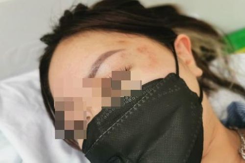 Cô gái trẻ tố bị 'bóp mông', hành hung tại trung tâm thương mại