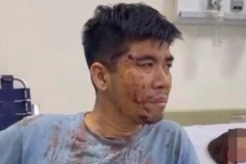 Lời khai của nhóm đối tượng vụ 2 gia đình hỗn chiến khiến 1 người tử vong
