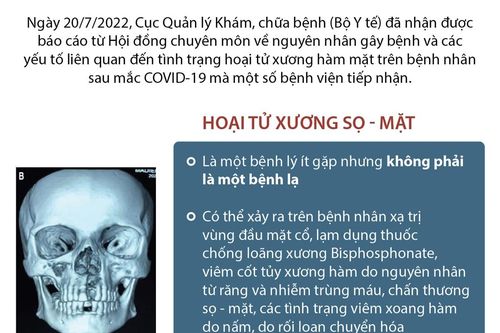 Kết luận về tình trạng hoại tử xương hàm mặt sau mắc COVID-19