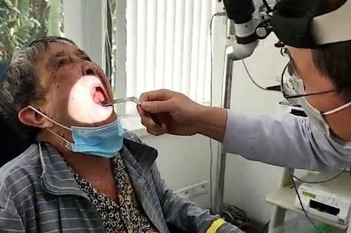 Cụ bà ăn cháo loãng suốt 2 năm do bị khối u xương khẩu cái hiếm gặp
