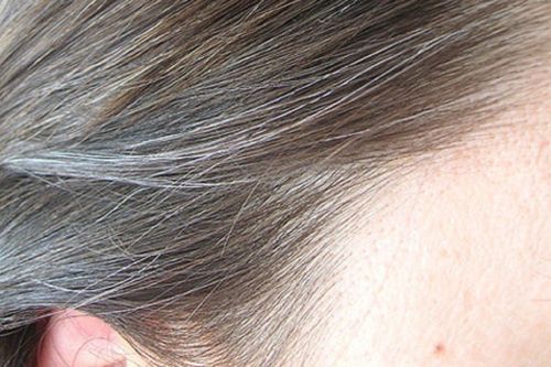 Thủ phạm khiến tóc bạc trắng khi mới 20 tuổi
