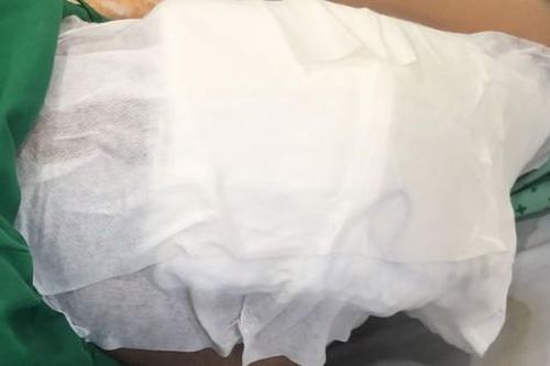 Hậu quả khó lường từ đắp thuốc nam, thuốc lá không rõ nguồn gốc