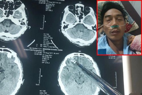 Yêu cầu điều tra vụ dân tố bị đánh nhưng công an huyện ở Gia Lai không khởi tố