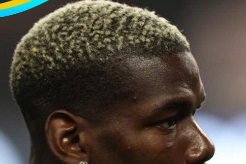 Vừa quay lại Juve, Pogba đã chấn thương và có thể phải nghỉ 2 tháng