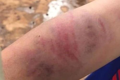 Khởi tố người bố và bà nội bạo hành dã man bé 9 tuổi