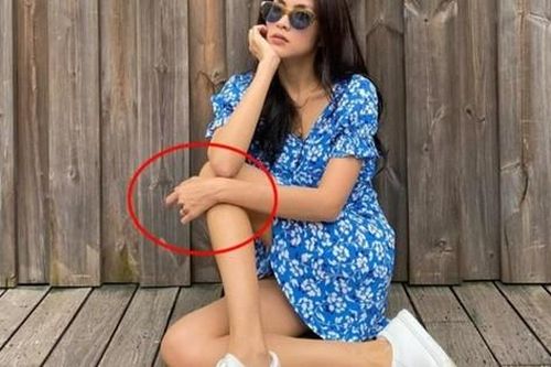 Tăng Thanh Hà lần đầu chia sẻ về căn bệnh đeo đẳng suốt 3 năm gây sụt cân, tăng nguy cơ ung thư cao khiến cô vô cùng lo lắng