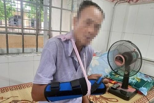 Quảng Trị: Một người đàn ông 65 tuổi nhập viện điều trị vì bị khỉ vàng tấn công