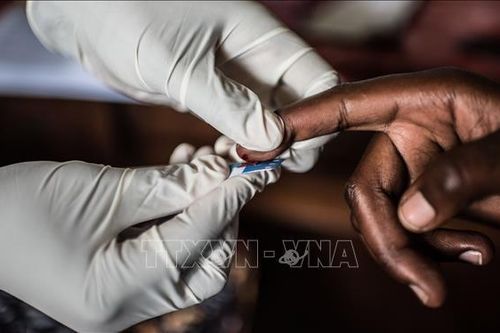 Mỹ Latinh thụt lùi trong cuộc chiến chống HIV/AIDS