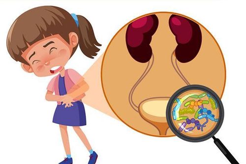 Những việc cần làm hằng ngày để phòng bệnh nhiễm khuẩn tiết niệu ở bé gái