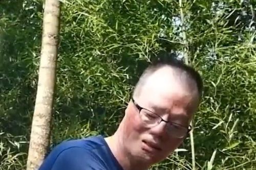Lính cứu hỏa Trung Quốc bỏng 75% cơ thể khi chữa cháy