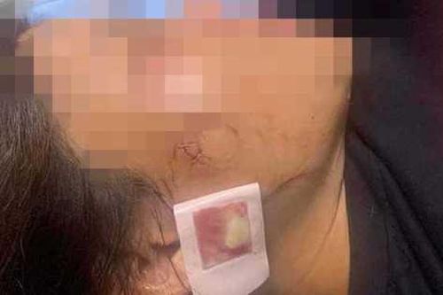 Thanh Hóa: Thông tin mới nhất người phụ nữ bị thương sau tiếng nổ lớn