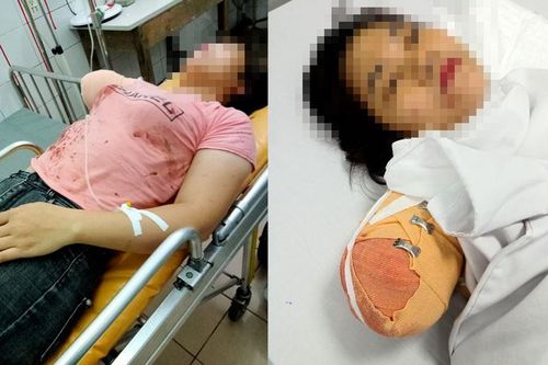 Vụ nữ công nhân đứt lìa cánh tay: Tâm sự nhói lòng của người chồng