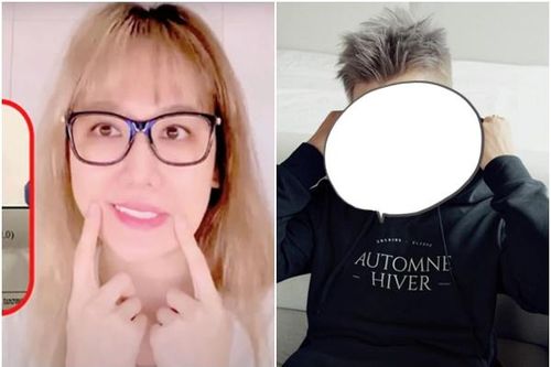 Không chỉ Hari, một nghệ sĩ Việt cũng tưởng mất sự nghiệp vì bị liệt nửa mặt