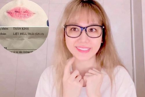 Hari won tiết lộ về tình trạng sức khỏe hiện tại, tinh thần suy sụp vì bị liệt cơ mặt