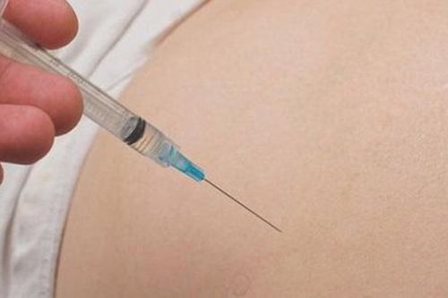Cô gái trẻ gặp biến chứng áp xe, sưng phù đầu gối, cẳng chân sau tiêm filler