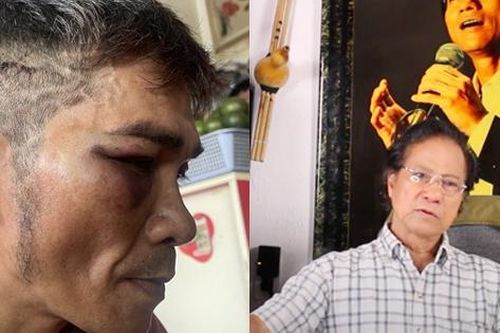 Con trai Chế Linh bị đánh hội đồng, người cha từ Mỹ nói gì?