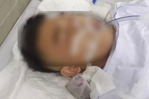 Côn đồ nổ súng vào nhà hàng xóm, bắn trọng thương 1 người dân