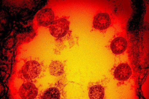 Hơn 65 nghìn người nhiễm virus giống chủng SARS-CoV ở Đông Nam Á mỗi năm