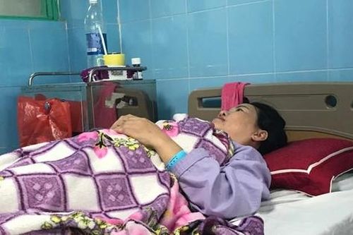 Một phụ nữ bị sán làm tổ trong não