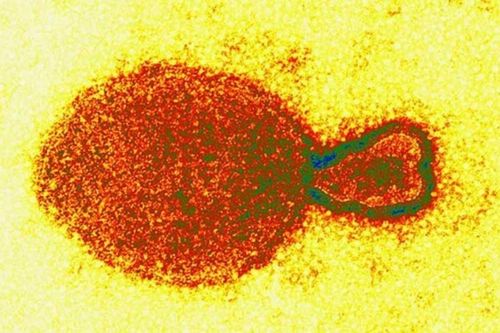 Virus mới phát hiện ở Trung Quốc nguy hiểm thế nào?