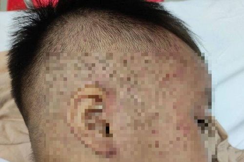 Sức khỏe của bé trai 3 tuổi nghi bị cho vào tủ cấp đông