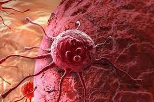 Thuộc lòng những biểu hiện của khối u ác tính này để đi khám ngay kẻo muộn