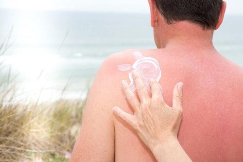 Báo động số ca mắc ung thư da ở nam giới mùa nắng nóng