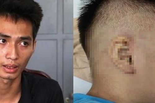Bé trai 3 tuổi bị đánh đập, nhét tủ đông sẽ nguy hiểm tính mạng thế nào nếu không được phát hiện kịp thời?