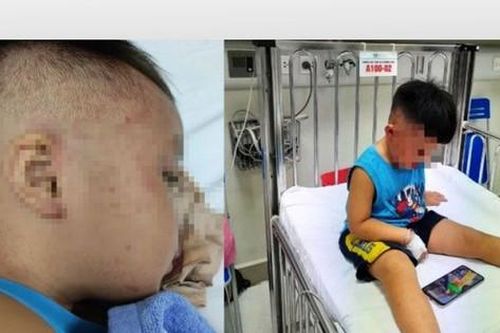 Chuyên gia cấp cứu, hồi sức nói gì về vụ bé 3 tuổi bị nhốt vào tủ cấp đông?