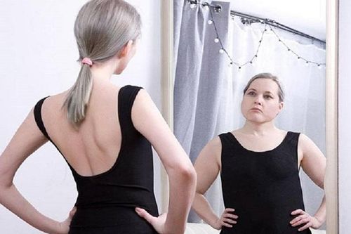 Hội chứng khiến người bệnh luôn mặc cảm về ngoại hình
