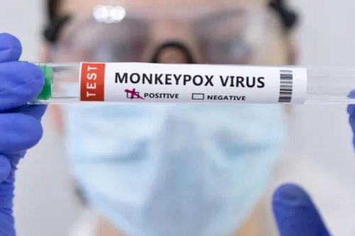 Ca nghi lây nhiễm virus gây bệnh đậu mùa khỉ từ người sang chó đầu tiên được phát hiện