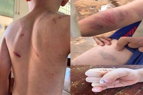 Kịp thời phát hiện nguy cơ bị bạo hành đối với trẻ em có cha mẹ ly hôn