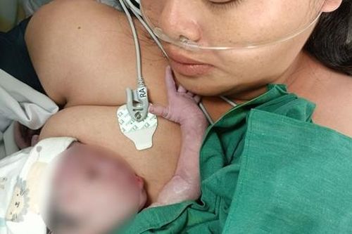 Mổ lấy thai cứu sản phụ dọa vỡ tử cung