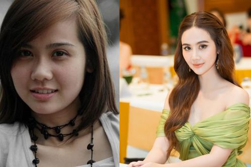 Chỉ thay đổi một điểm nhỏ trên khuôn mặt, nhan sắc Huyền Lizzie nâng tầm thấy rõ