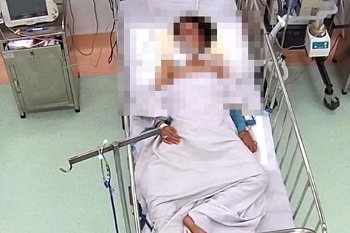 Bé trai bị rắn cạp nia cắn nguy kịch lúc nửa đêm