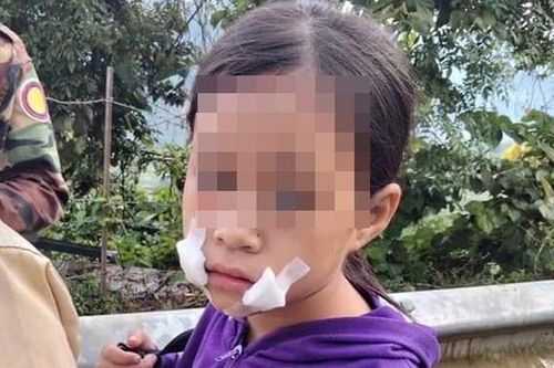 Bán hoa quả bên lề đường, bé gái 9 tuổi bị thanh niên bịt miệng cướp tài sản