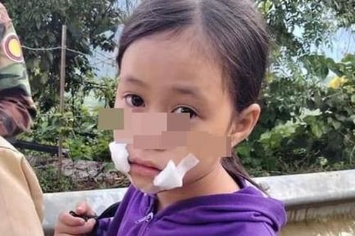 Bé gái 9 tuổi bán hàng ven đường bị cướp tấn công, dao cứa rách miệng
