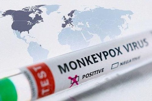 Cuba xác nhận trường hợp đầu tiên mắc bệnh đậu mùa khỉ