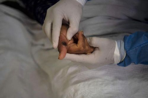 Virus đậu mùa khỉ có thể bám lâu trên các vật dụng gia đình