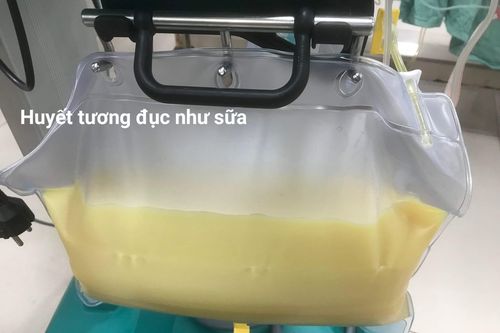 Bệnh nhân viêm tụy cấp có huyết tương trắng như sữa cực kỳ nguy hiểm