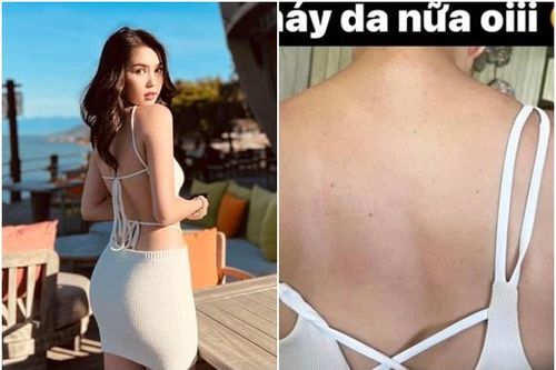 Mải chụp bikini, Ngọc Trinh bị cháy nắng, da lộ nhiều khuyết điểm