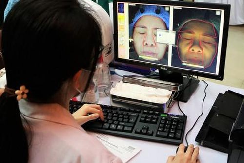 Làm đẹp 'tái sinh đa tầng', một phụ nữ lệch mặt