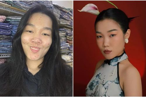 Cô gái 'nhiều lông nách nhất Tiktok' khoe hình ảnh 'lột xác' khiến nhiều người thích thú