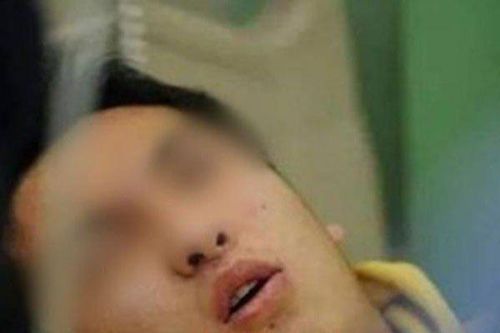 Ăn món nhiều người cho là đại bổ, người đàn ông bị chẩn đoán suy thận