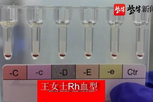 Trung Quốc phát hiện 2 người có 'nhóm máu vàng' hiếm nhất Trái Đất