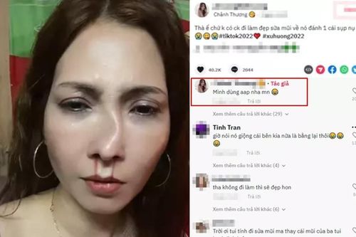 Người phụ nữ đăng đàn tố bị chồng đánh 'tòe mũi' mới nâng và sự thật khiến dân mạng bực mình