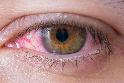 Quan hệ với bạn gái quen qua mạng xã hội, nam thanh niên bị lậu mắt