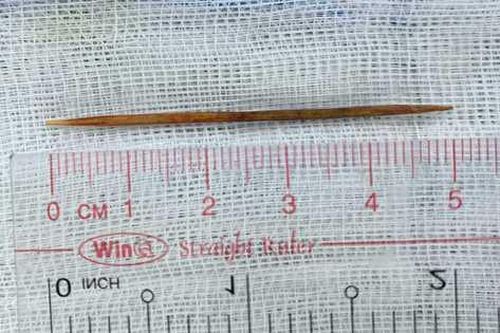 Nuốt phải tăm xỉa răng, bé 8 tuổi thủng tá tràng